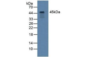 Figure. (SERPINB3 Antikörper  (AA 1-210))