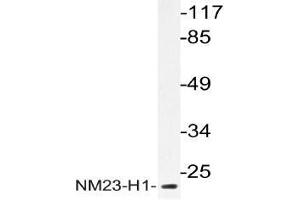 Western blot (WB) analysis of NM23-H1 antibody in extracts from HeLa cells. (NME1 Antikörper)