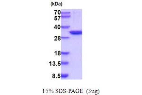 CA13 Protein (AA 1-262) (His tag)