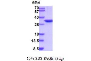 SDS-PAGE (SDS) image for Carbonic Anhydrase XIII (CA13) (AA 1-262) (Active) protein (His tag) (ABIN5854197) (CA13 Protein (AA 1-262) (His tag))