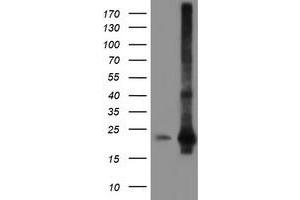 HEK293T cells were transfected with the pCMV6-ENTRY control (Left lane) or pCMV6-ENTRY SAT2 (Right lane) cDNA for 48 hrs and lysed. (SAT2 Antikörper)