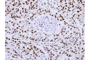 Immunohistochemistry (IHC) image for anti-Heterogeneous Nuclear Ribonucleoprotein F (HNRNPF) antibody (ABIN2856959)
