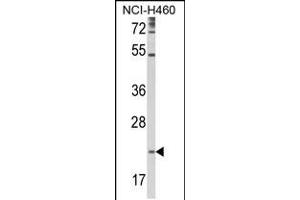 Western blot analysis of TSPAN31 Antibody in NCI-H460 cell line lysates (35ug/lane)(2ug/ml) (TSPAN31 Antikörper  (AA 102-128))