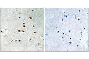Immunohistochemical analysis of paraffin-embedded human brain tissue using ITCH (Phospho-Tyr420) antibody (left)or the same antibody preincubated with blocking peptide (right). (ITCH Antikörper  (pTyr420))