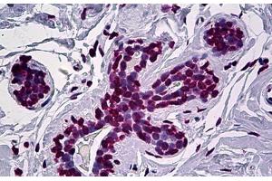 Human Breast: Formalin-Fixed, Paraffin-Embedded (FFPE) (EN1 Antikörper  (AA 266-392))