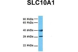 Host:  Rabbit  Target Name:  SLC10A1  Sample Tissue:  Human MDA-MB-435s  Antibody Dilution:  1.