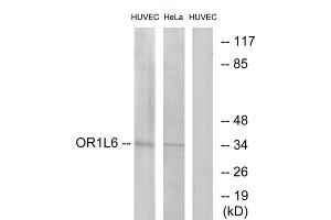 Western blot analysis of extracts from HUVEC cells and HeLa cells, using OR1L6 antibody. (OR1L6 Antikörper  (Internal Region))
