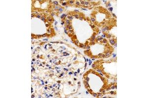 Immunohistochemistry (Paraffin-embedded Sections) (IHC (p)) image for anti-Fms-Related Tyrosine Kinase 4 (FLT4) (AA 1-439) antibody (ABIN1882290)