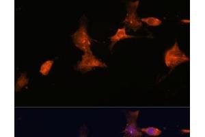 Immunofluorescence analysis of C6 cells using TSC2 Polyclonal Antibody at dilution of 1:100. (Tuberin Antikörper)