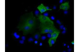 Image no. 7 for anti-Proteasome (Prosome, Macropain) 26S Subunit, ATPase, 3 (PSMC3) antibody (ABIN1501331) (PSMC3 Antikörper)