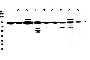 Western Blotting (WB) image for anti-X-Ray Repair Complementing Defective Repair in Chinese Hamster Cells 1 (XRCC1) (AA 538-633) antibody (ABIN5693138)