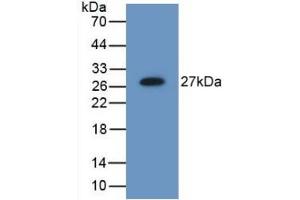 Detection of Recombinant MB21D1, Mouse using Polyclonal Antibody to Mab21 Domain Containing Protein 1 (MB21D1)