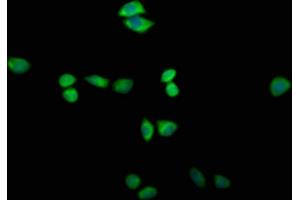 Immunofluorescence staining of Hela cells with ABIN7171907 at 1:200, counter-stained with DAPI. (TTC14 Antikörper  (AA 569-770))