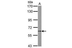 Image no. 2 for anti-Nicotinic Acetylcholine Receptor beta (CHRNB1) (AA 274-501) antibody (ABIN1497506) (CHRNB1 Antikörper  (AA 274-501))