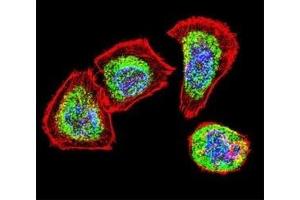 Confocal immunofluorescent analysis of Vimentin antibody with U251 cells followed by Alexa Fluor 488-conjugated goat anti-rabbit lgG (green).