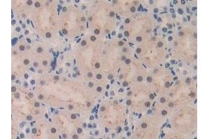 Immunohistochemistry (IHC) image for anti-Chemokine (C-C Motif) Ligand 4 (CCL4) (AA 24-92) antibody (ABIN7430945)