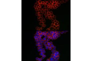 Immunofluorescence analysis of THP-1 cells using CD38 Rabbit pAb (ABIN3015544, ABIN3015545, ABIN1679089 and ABIN6218776) at dilution of 1:100 (40x lens). (CD38 Antikörper  (AA 1-300))