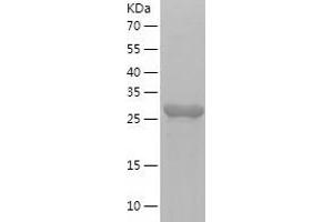 Western Blotting (WB) image for CD34 (CD34) (AA 32-290) protein (His-IF2DI Tag) (ABIN7122202)