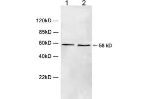 Western blot analysis of cell lysate using 1 µg/mL Rabbit Anti-Chk1 (Ser280) Polyclonal Antibody (ABIN398709) Lane 1: Hela cell lysateLane 2: HEK293 cell lysateThe signal was developed with IRDyeTM 800 Conjugated Goat Anti-Rabbit IgG. (CHEK1 Antikörper  (Ser280))
