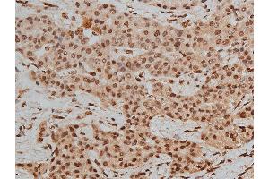Immunohistochemistry (IHC) image for anti-Histone Deacetylase 3 (HDAC3) (pSer424) antibody (ABIN6256332)