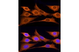 Immunofluorescence (IF) image for anti-Iduronate 2-Sulfatase (IDS) (AA 34-290) antibody (ABIN3015634)