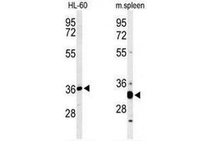 LEFT: Western blot analysis of ST8SIA4 Antibody (Center) in HL-60 cell line lysates (35µg/lane).