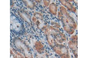 Used in DAB staining on fromalin fixed paraffin- embedded Kidney tissue (TBCA Antikörper  (AA 2-108))