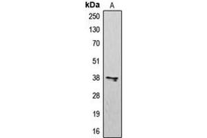 Western blot analysis of CD183 expression in K562 (A) whole cell lysates. (CXCR3 Antikörper  (Center))