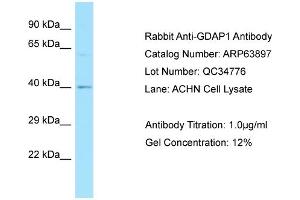 Western Blotting (WB) image for anti-Ganglioside-Induced Differentiation-Associated Protein 1 (GDAP1) (Middle Region) antibody (ABIN2789658) (GDAP1 Antikörper  (Middle Region))