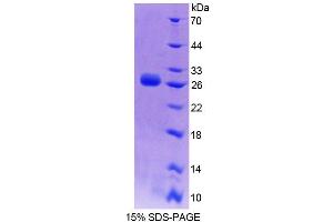 SDS-PAGE (SDS) image for Dystrophia Myotonica-Protein Kinase (DMPK) (AA 1-201) protein (His tag) (ABIN6239118)
