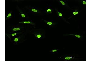 Immunofluorescence of purified MaxPab antibody to SSB on HeLa cell. (SSB Antikörper  (AA 1-408))