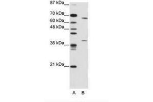 Image no. 2 for anti-Grainyhead-Like 3 (GRHL3) (AA 529-578) antibody (ABIN203223) (GRHL3 Antikörper  (AA 529-578))