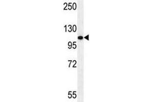 Androgen Receptor antibody western blot analysis in HeLa lysate (Androgen Receptor Antikörper  (AA 365-392))