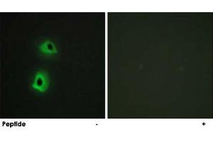Immunofluorescence analysis of HeLa cells, using TRAF3IP3 polyclonal antibody . (TRAF3IP3 Antikörper)