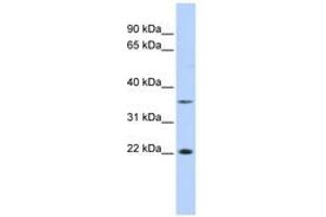Image no. 1 for anti-Chromosome 16 Open Reading Frame 80 (C16orf80) (C-Term) antibody (ABIN6742820) (C16orf80 Antikörper  (C-Term))