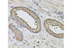 Immunohistochemistry of paraffin-embedded Human prostate using S100A12 Polyclonal Antibody at dilution of 1:100 (40x lens). (S100A12 Antikörper)