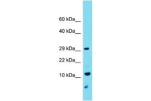 Host: Rabbit Target Name: C9orf123 Sample Type: U937 Whole Cell lysates Antibody Dilution: 1. (C9orf123 Antikörper  (C-Term))