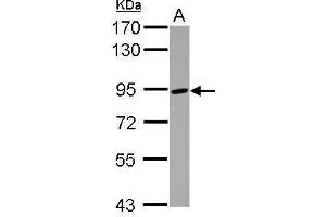 WB Image Sample (30 ug of whole cell lysate) A: Raji 7. (ADAM8 Antikörper  (C-Term))