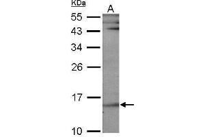WB Image Sample (30 ug of whole cell lysate) A: NIH-3T3 12% SDS PAGE antibody diluted at 1:1000 (UBE2B Antikörper)