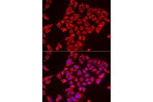 Immunofluorescence analysis of HeLa cell using ST3GAL3 antibody. (ST3GAL3 Antikörper)