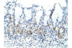 ADAT1 antibody was used for immunohistochemistry at a concentration of 4-8 ug/ml to stain Epithelial cells of fundic gland (arrows) in Human Stomach. (ADAT1 Antikörper  (C-Term))