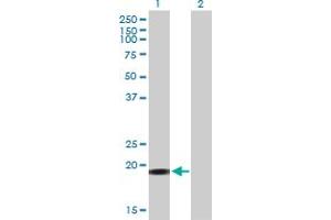 Western Blot analysis of YSK4 expression in transfected 293T cell line by YSK4 MaxPab polyclonal antibody. (MAP3K19 Antikörper  (AA 1-168))