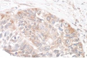 Immunohistochemistry (IHC) image for anti-RPTOR Independent Companion of mTOR, Complex 2 (RICTOR) (C-Term) antibody (ABIN7454633) (RICTOR Antikörper  (C-Term))