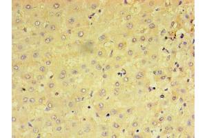 Immunohistochemistry of paraffin-embedded human liver tissue using ABIN7159237 at dilution of 1:100 (PRAME Antikörper  (AA 1-509))