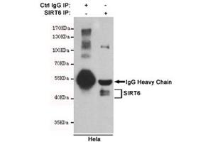 Immunoprecipitation of SIRT6 from HeLa cell lysate using SIRT6 antibody.