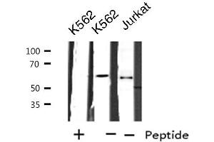Western blot analysis of extracts from K562/Jurkat cells, using CYP2A7 antibody. (CYP2A7 Antikörper)