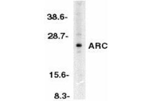 Western blot analysis of ARC in HeLa whole cell lysates with AP30077PU-N ARC antibody at 1/500 dilution. (NOL3 Antikörper  (N-Term))