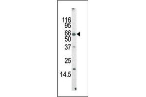 The anti-MLLT3 Pab (ABIN390129 and ABIN2840634) is used in Western blot to detect MLLT3 in mouse cerebellum tissue lysate (AF9 Antikörper  (AA 407-438))