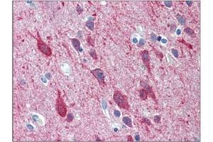 Immunohistochemistry (Paraffin-embedded Sections) (IHC (p)) image for anti-Potassium Voltage-Gated Channel, Shaw-Related Subfamily, Member 2 (KCNC2) (C-Term) antibody (ABIN784577)