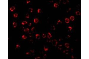 Immunofluorescence of PUMA in K562 cells with this product at 2 µg/ml. (PUMA Antikörper  (C-Term))